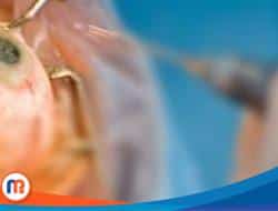 Gubernur Jatim Dukung Perdami, Komatda dan Eyelink Kolaborasi Gelar Baksos Operasi Katarak