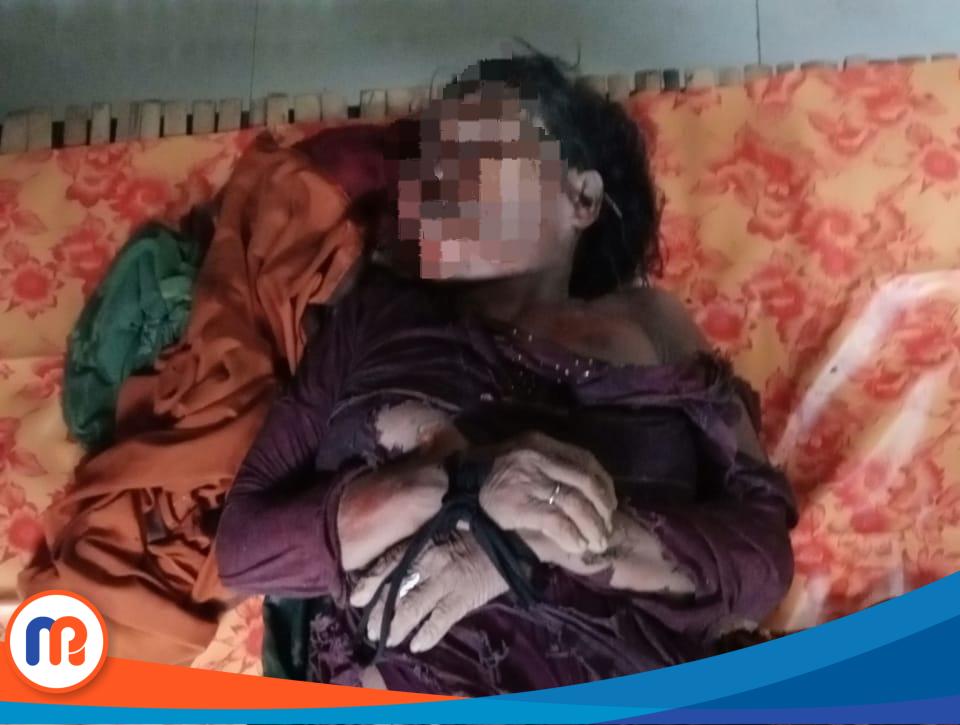 Potret kondisi korban tersambar petir yang menewaskan petani di Sumenep