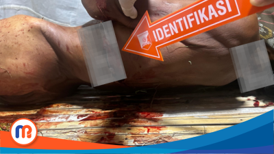 Petugas saat mengidentifikasi luka pada tubuh korban pembunuhan