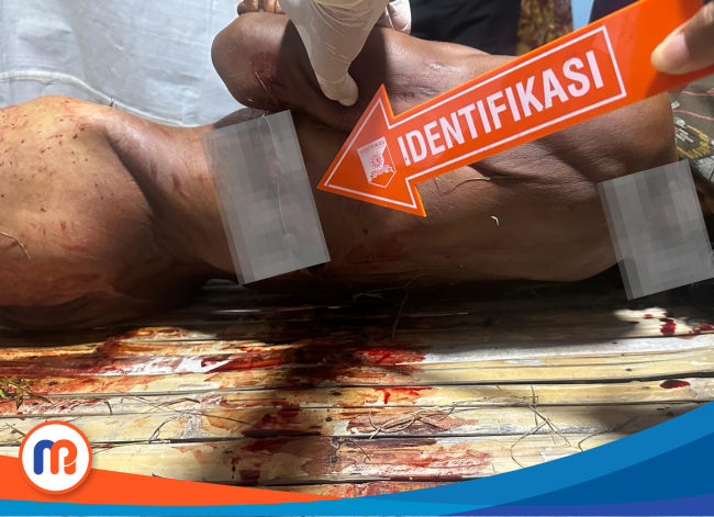 Petugas saat mengidentifikasi luka pada tubuh korban pembunuhan